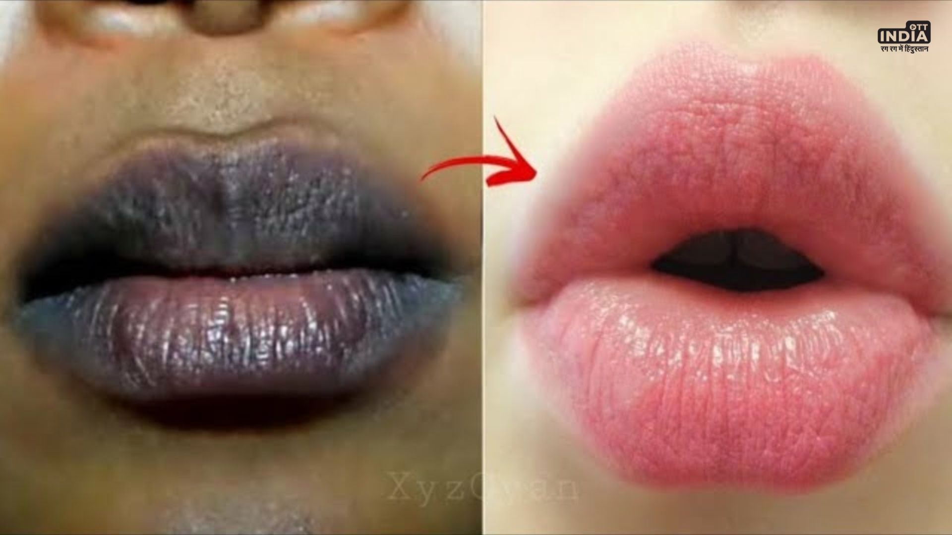 Lips Brightening Tips These tricks can make your lips bright