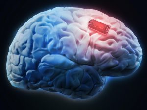 Neuralink Brain Chip