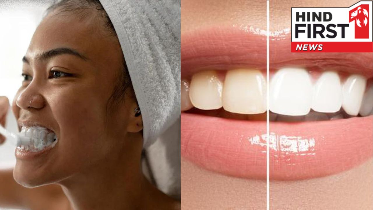 Remove Strain From Teeth : पीले पड़ गए दांतों से है परेशान तो अपनाएं ये 5 घरेलू उपचार