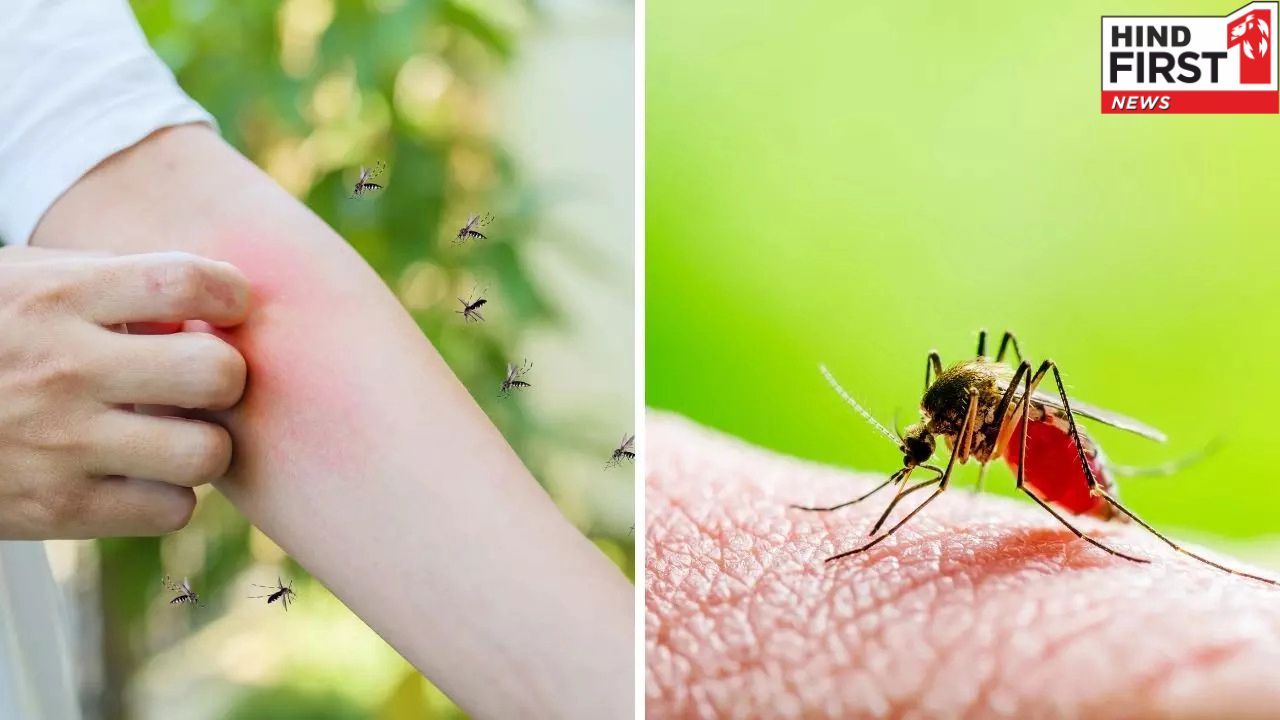 Dengue Mosquito: ऐसे पहचाने डेंगू के मच्छर को, जानें कैसे करें इनसे बचाव