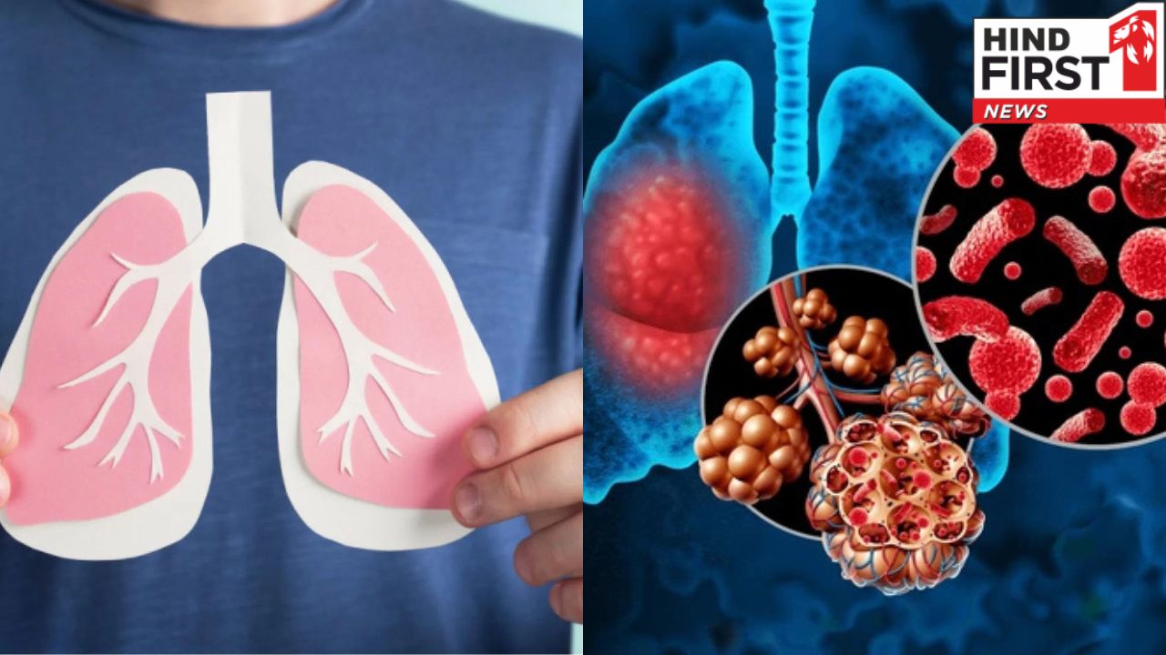 Pneumonia Disease: पांच साल से कम उम्र के बच्चों में मौत का सबसे बड़ा कारण है निमोनिया, जानें इससे बचने के उपाय