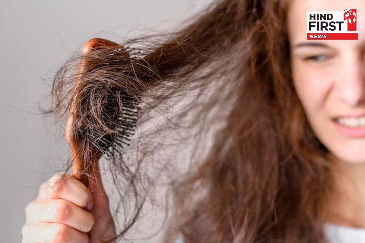 Diet For Haircare : बालों के झड़ने से हैं परेशान ? डाइट में तुरंत शामिल करें ये चीजें, चंद दिनों में दिखेगा अंतर