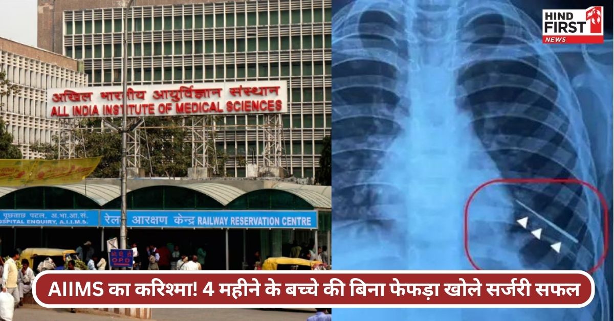 दिल्ली AIIMS CLO सर्जरी: बिना फेफड़ा खोले 4 महीने के बच्चे की दुर्लभ बीमारी का सफल ऑपरेशन