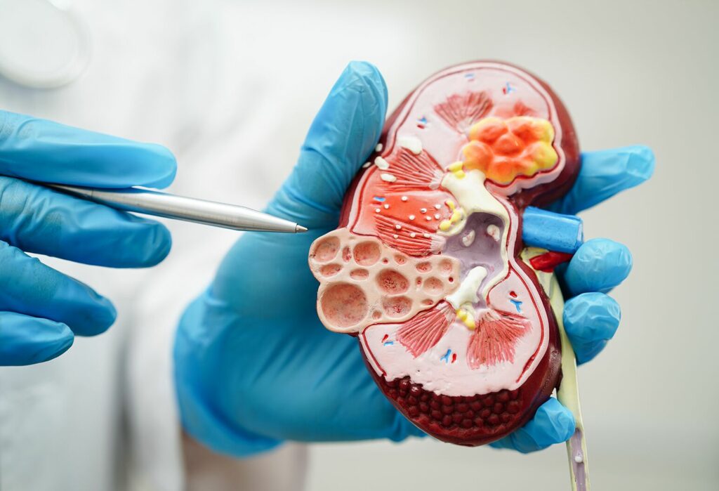 Kidney failure causes